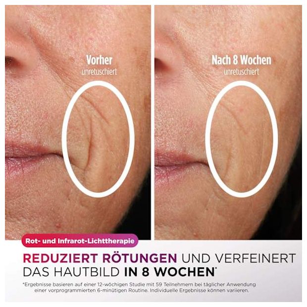 FW312EUPL CryoGlow LED-Maske + Kühlung der Augenpartie 