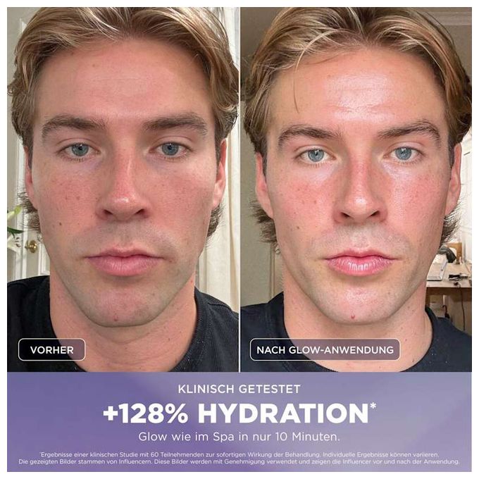 FH320EU FacialPro Glow Hydro Gesichtspflegesystem 