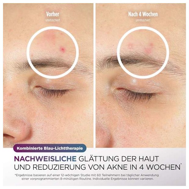 FW312EUPL CryoGlow LED-Maske + Kühlung der Augenpartie 
